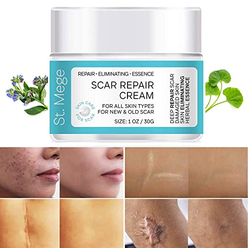 Best Acne Scar Removal Cream In 2022